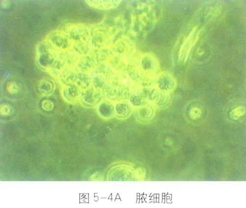 流脓