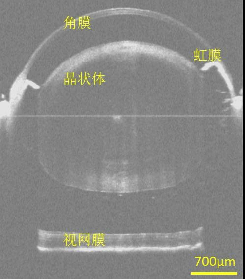 光学相干层析成像