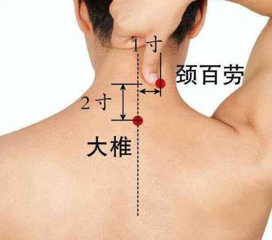 百劳穴