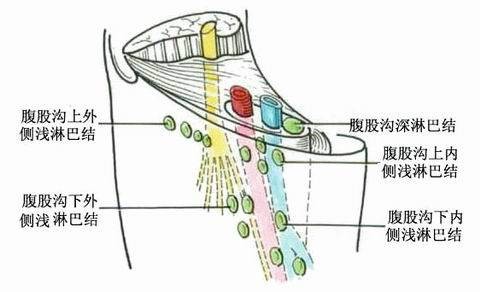 腹股沟淋巴结