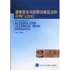 湿疹皮炎与皮肤过敏反应的诊断与治疗(2010年北京大学医学出版社出版的图书)