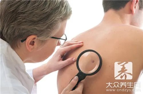 痣相图解大全