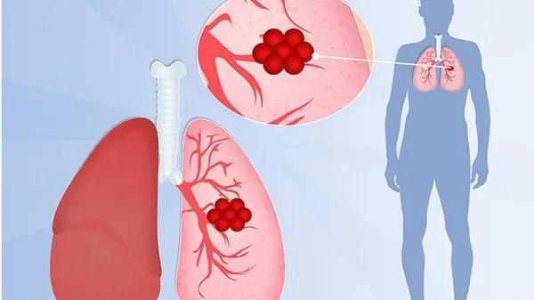 单日新增确诊超7万例，超三分之一美国人身边有人死于新冠