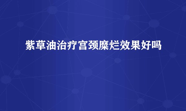 紫草油治疗宫颈糜烂效果好吗