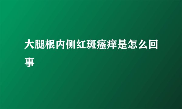 大腿根内侧红斑瘙痒是怎么回事