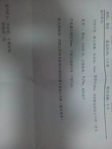 脐点1988的介绍