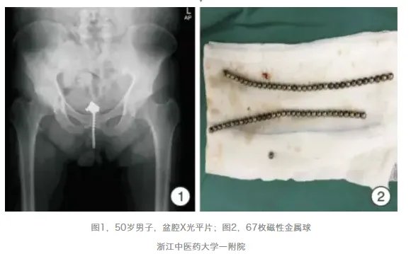别往菊花和丁丁里塞奇怪的东西了，取出来的时候很疼的！