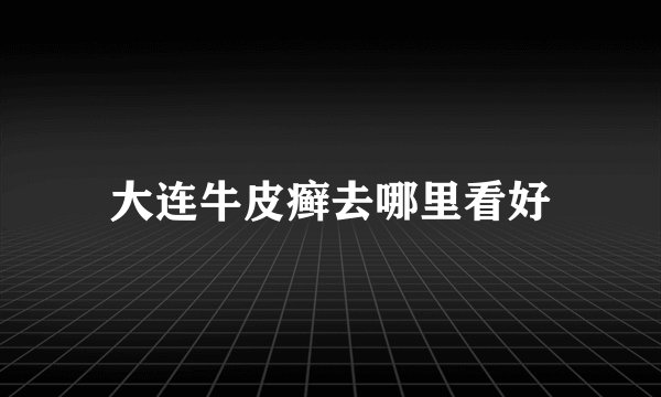大连牛皮癣去哪里看好