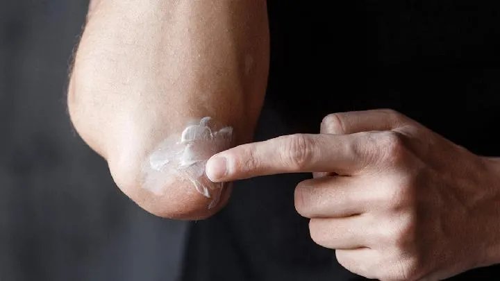 什么是白癜风