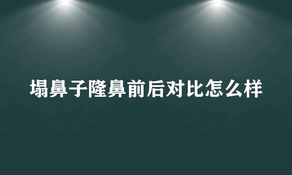 塌鼻子隆鼻前后对比怎么样