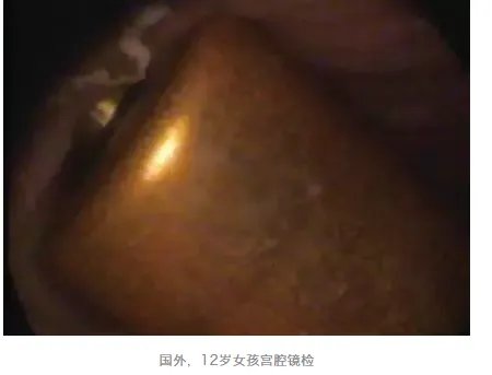 别往菊花和丁丁里塞奇怪的东西了，取出来的时候很疼的！