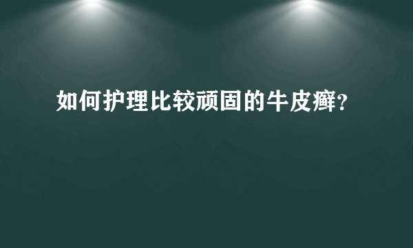 如何护理比较顽固的牛皮癣?