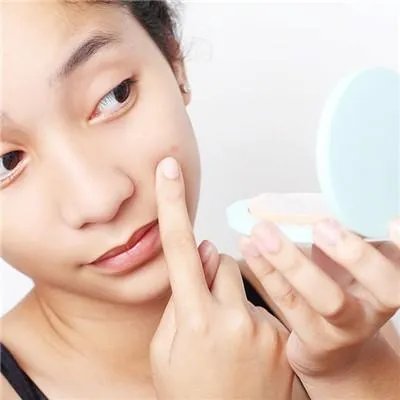 激光去痘印价格是多少