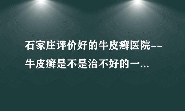 石家庄评价好的牛皮癣医院--牛皮癣是不是治不好的一种病吗？