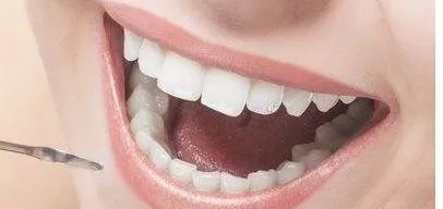 牙齿美白伤害牙齿吗