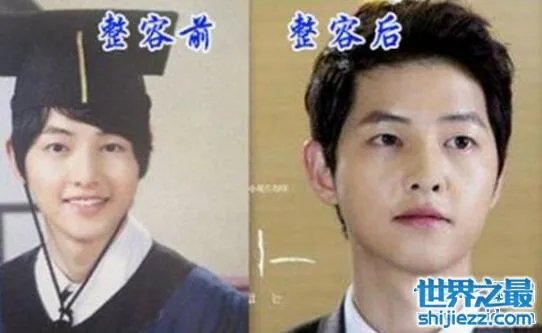 宋仲基整容前的照片对比,和亲妹妹容貌相差巨大