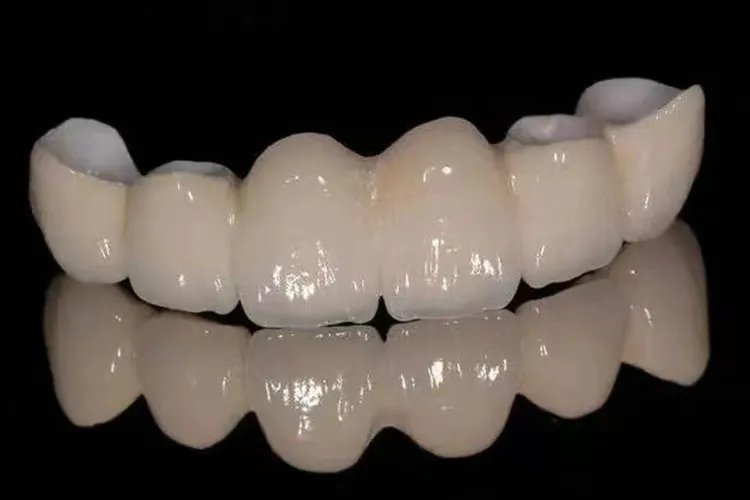 门牙6颗全瓷牙连冠图片