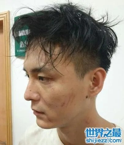 斗鱼狗哥被打事件,深夜户外直播遭遇黑社会暴打