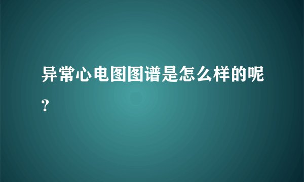 异常心电图图谱是怎么样的呢？