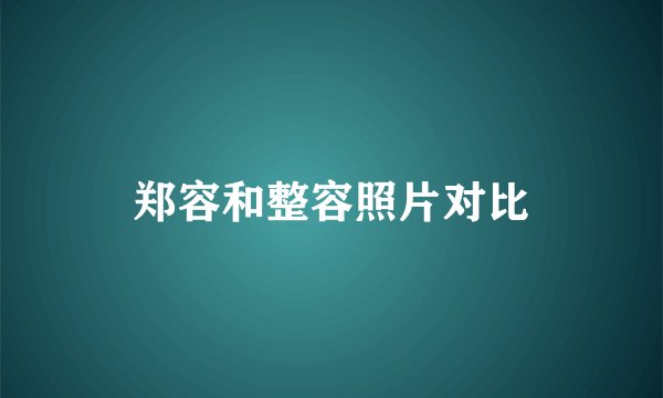 郑容和整容照片对比