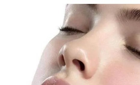 做鼻尖多少钱