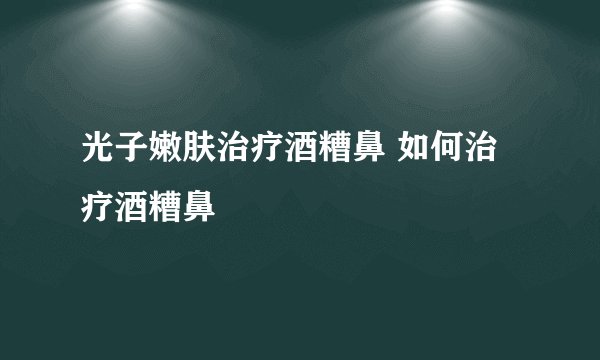 光子嫩肤治疗酒糟鼻 如何治疗酒糟鼻