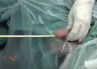 别往菊花和丁丁里塞奇怪的东西了，取出来的时候很疼的！
