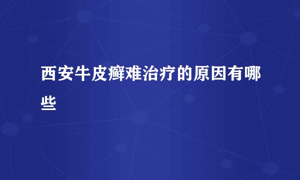 西安牛皮癣难治疗的原因有哪些