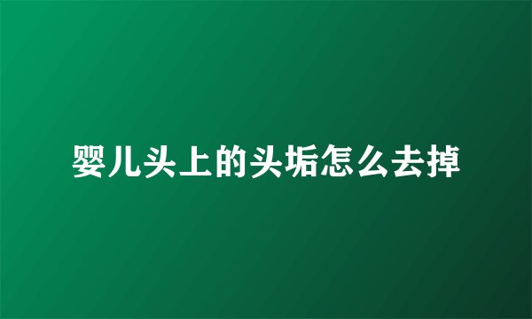 婴儿头上的头垢怎么去掉