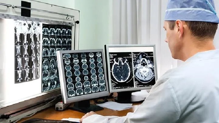 专家分析大脑萎缩临床表现