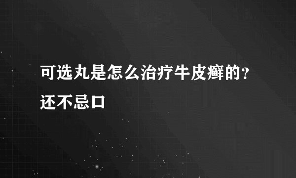 可选丸是怎么治疗牛皮癣的？还不忌口