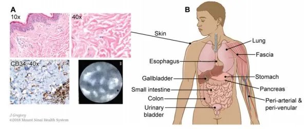 科学家在人体内发现未知新器官,人体究竟还有多秘密?