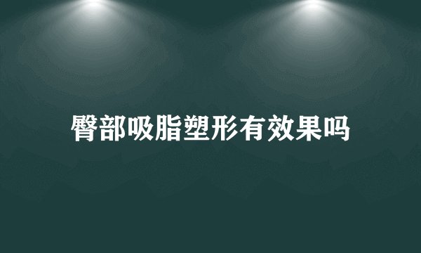 臀部吸脂塑形有效果吗