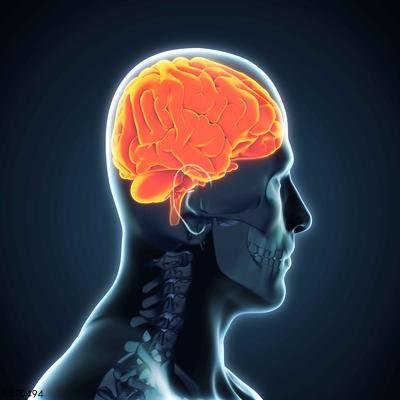 恶性脑肿瘤是怎么形成的 恶性脑肿瘤的形成原因细说