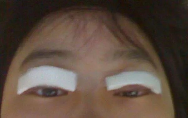北京好的眼部手术整形医院在哪？