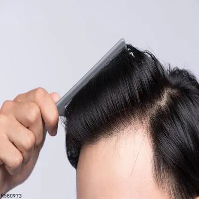 头部前面头发稀少怎么办