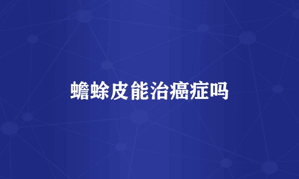 蟾蜍皮能治癌症吗