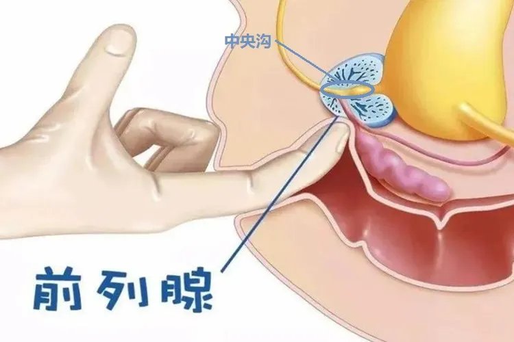 前列腺病自我按摩图解
