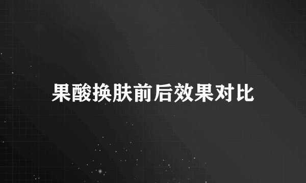果酸换肤前后效果对比