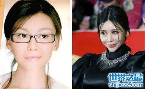 巩新亮整容前后差异大 网友直呼惨不忍睹