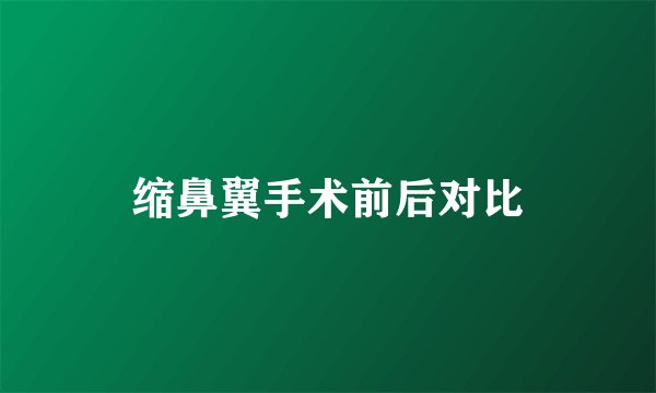 缩鼻翼手术前后对比