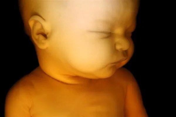 黑龙江产妇丈夫讲述遭遇，女人生孩子要面临10大风险，重者致命