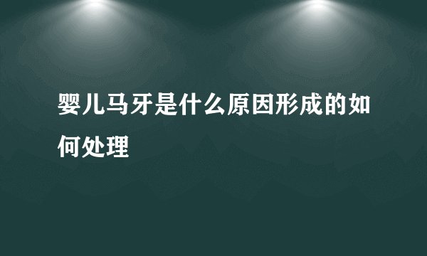 婴儿马牙是什么原因形成的如何处理