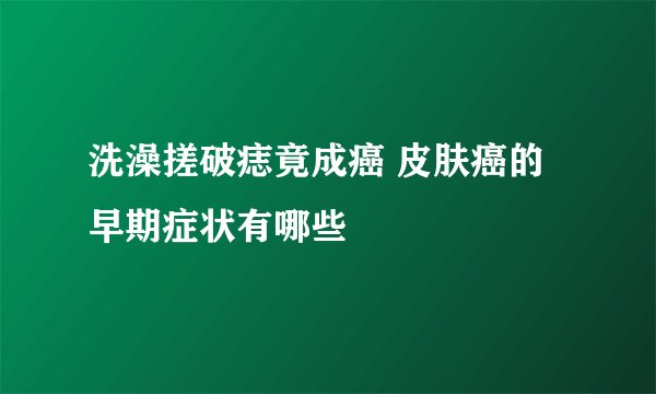 洗澡搓破痣竟成癌 皮肤癌的早期症状有哪些