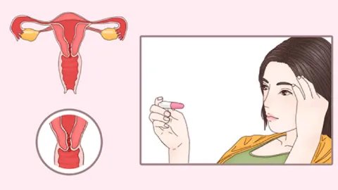 婴儿胚胎被冷冻还可以移植入子宫吗