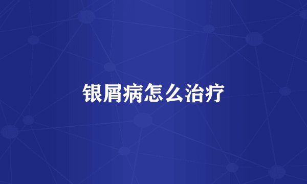 银屑病怎么治疗