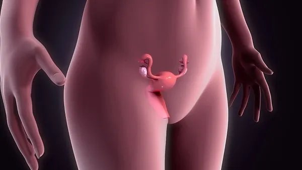 子宫位移如何治疗 三种治疗方法解决