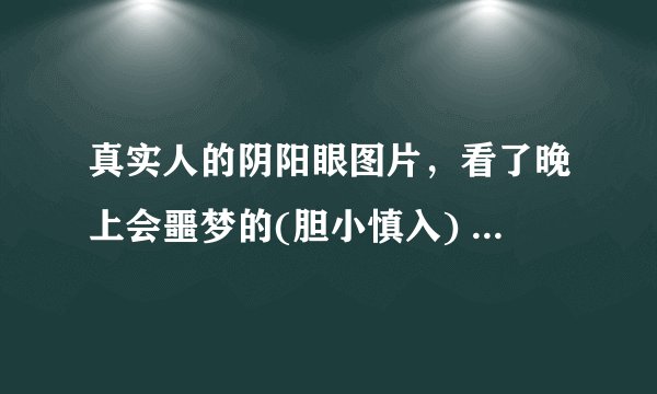 真实人的阴阳眼图片，看了晚上会噩梦的(胆小慎入) -飞外网