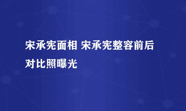 宋承宪面相 宋承宪整容前后对比照曝光