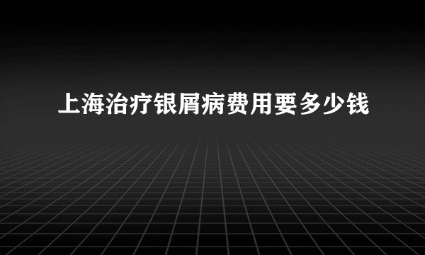 上海治疗银屑病费用要多少钱